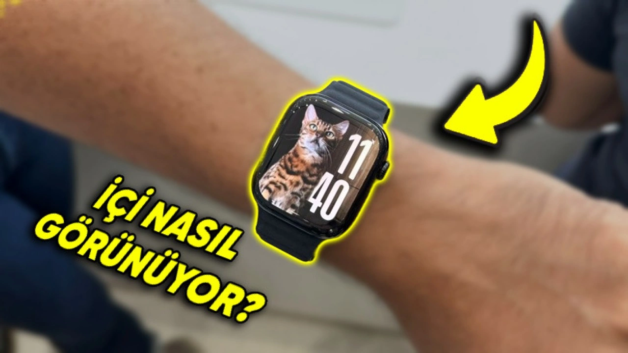 Apple Watch Series 10 Parçalarına Ayrıldı