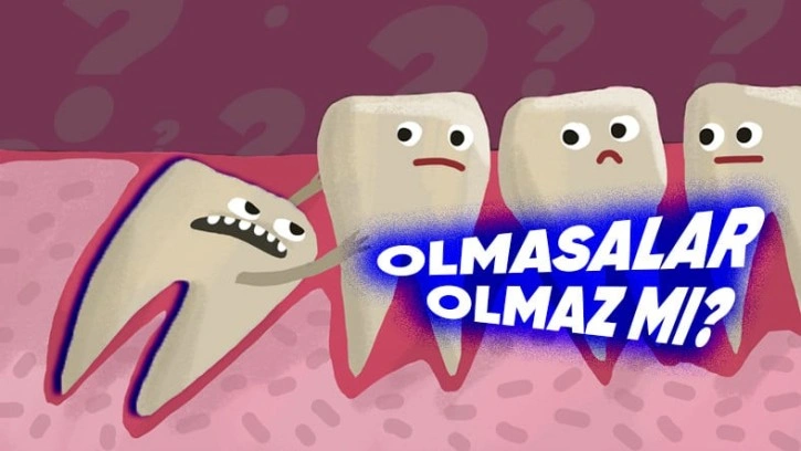 Yirmilik Dişlerimiz Neden Var, Olmasa da Olmaz mı?