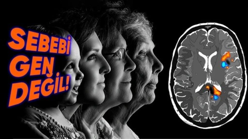 Dünyanın En Genç Alzheimer Olan İnsanının Şaşırtan Hikâyesi