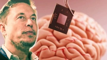 Neuralink Projesi İçin Ne Kadar Yatırım Toplandı?